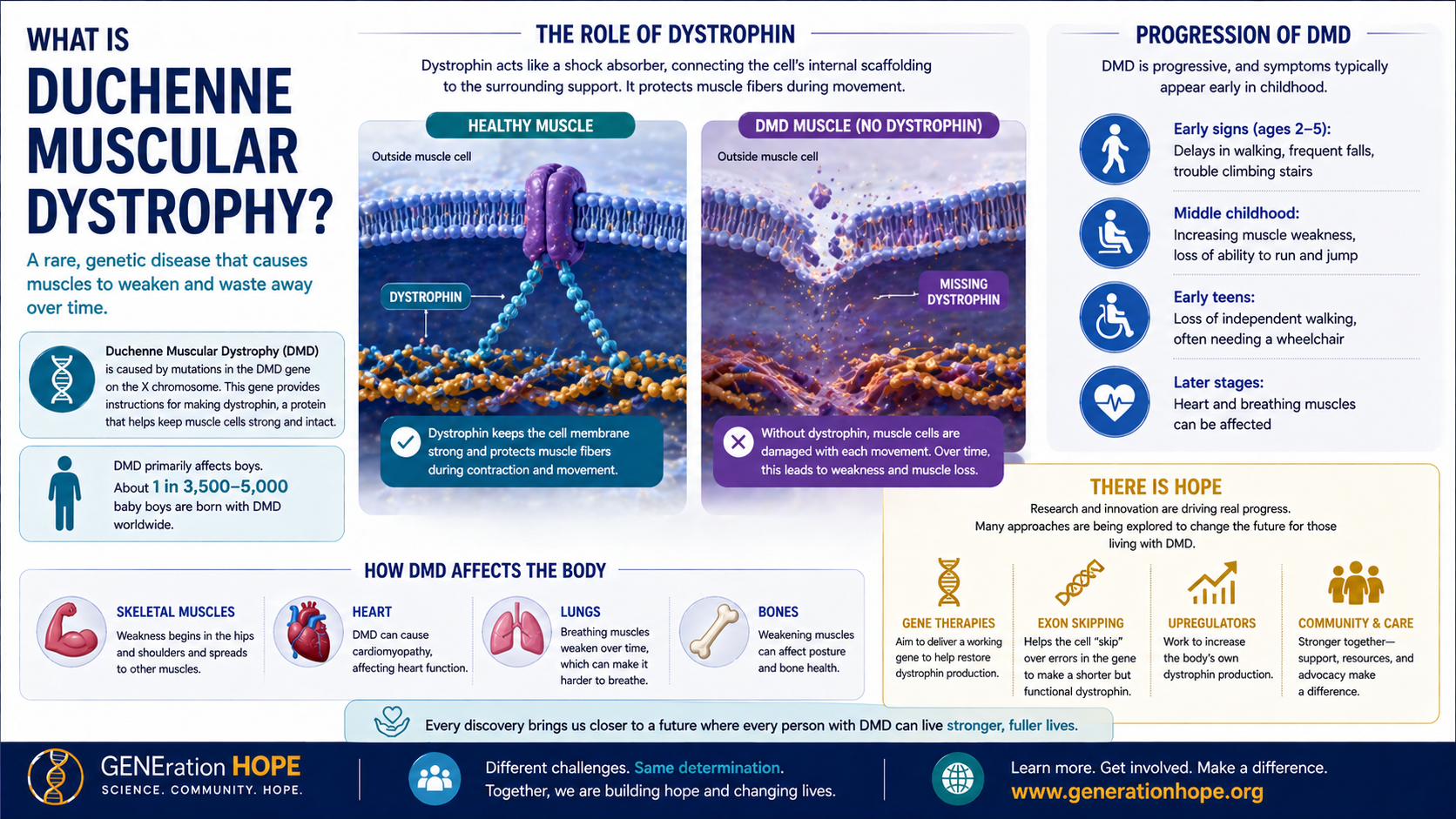 What Is Duchenne Muscular Dystrophy? explainer visual